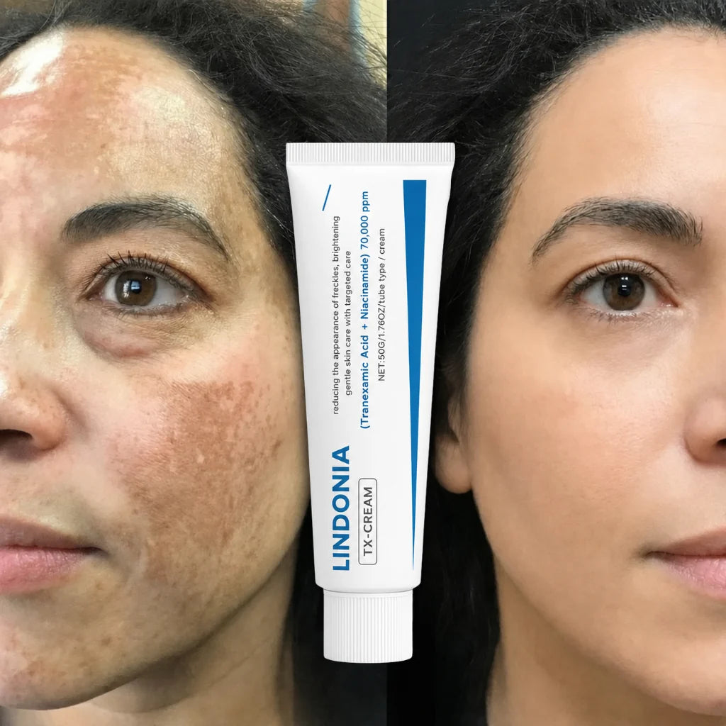 Lindonia® Corrector de Manchas